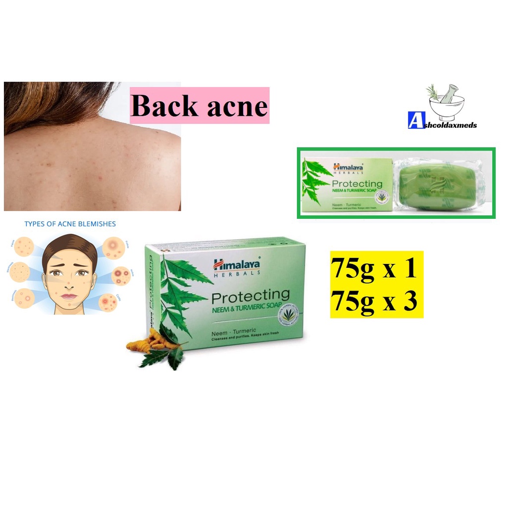 Himalaya Protecting Neem & Tumeric Soap 75g Farmasi Limbongan